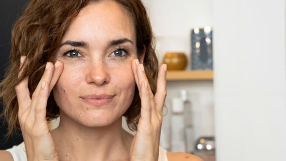 sunspots on face