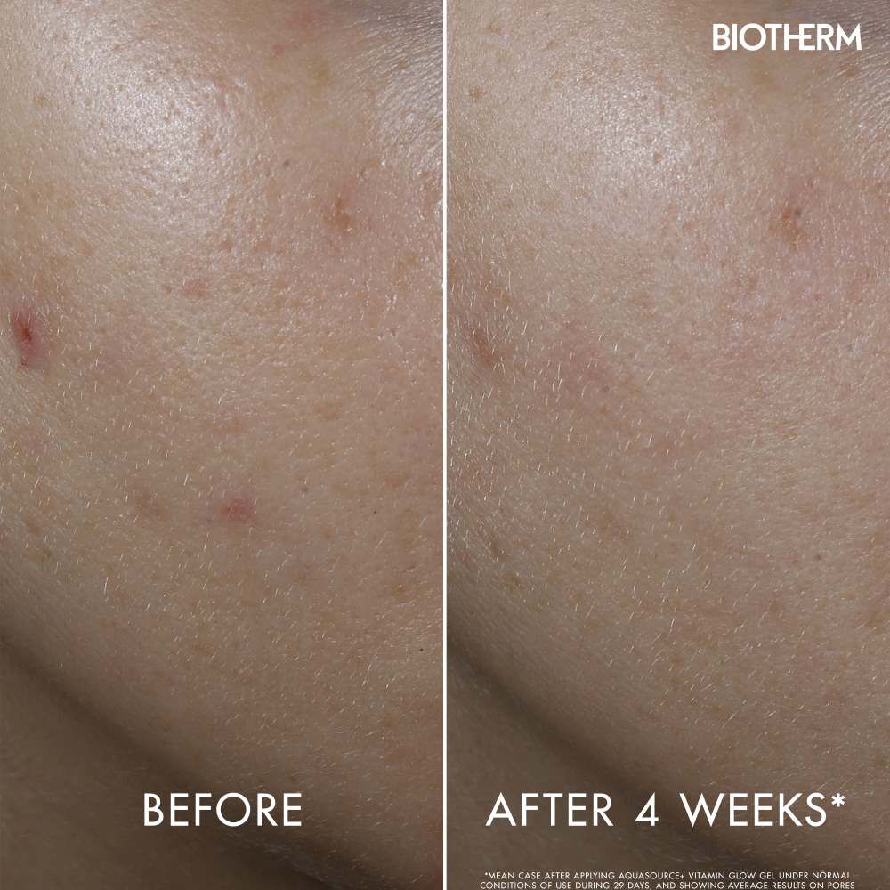 Zwei Hautbilder zeigen Veranderungen; links „BEFORE“, rechts „AFTER 4 WEEKS“. Verbesserung sichtbar.