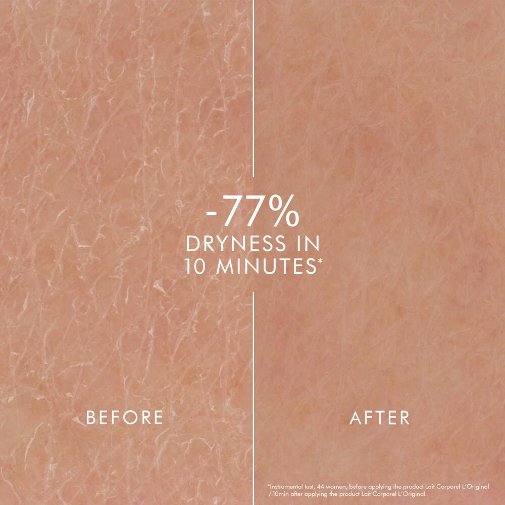 77% erwarten es nicht. Schonheit. Alter.